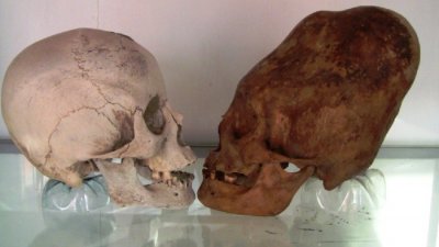 Porovnání běžné lebky a jedné z lebek z Paracas.