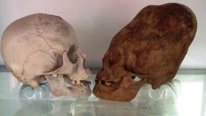 Porovnání běžné lebky a jedné z lebek z Paracas.